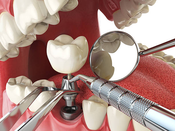 Professional Emergency Dental Service in PA